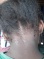 Sindrome De Brote